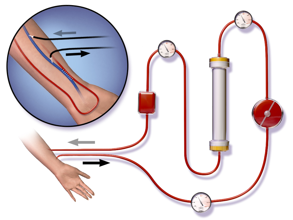 Dialysis Service